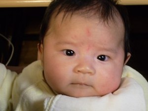 痛かったの。 痛かったの。